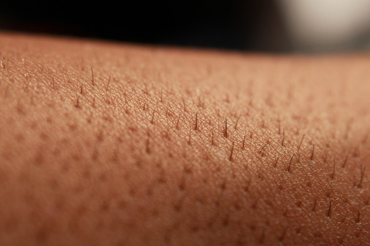 Poils sur peau